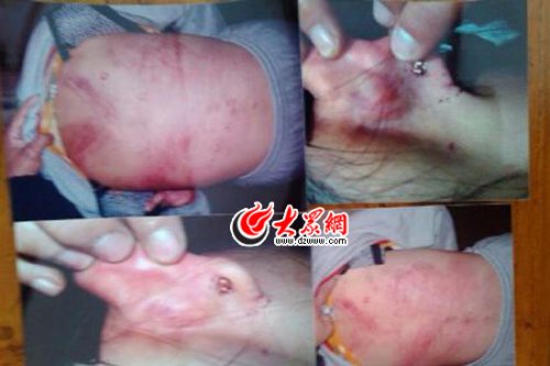 　山東藝術(shù)設(shè)計(jì)學(xué)院16歲女生宿舍內(nèi)被女同學(xué)暴打4小時(shí)。