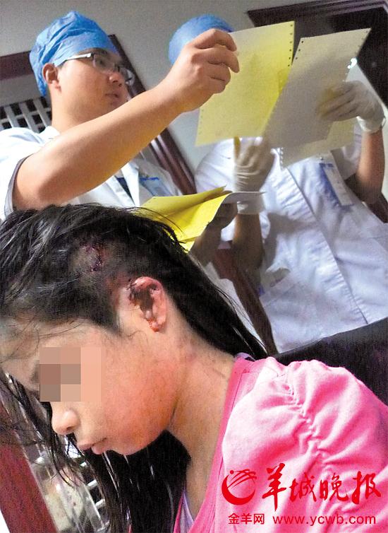 受傷的11歲女孩頭發(fā)被卷入扶梯，耳朵被嚴重拉傷，需手術(shù)。