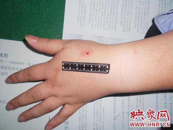 為幫助無證駕駛的朋友逃避處罰，新鄉(xiāng)的王某竟對執(zhí)勤民警大打出手，還將一名民警的手臂咬傷