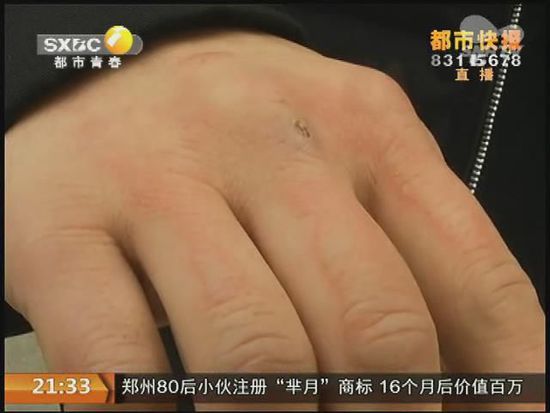 說到這足療拔罐，估計大伙都不陌生，但是想起4號晚上的拔罐的經(jīng)歷，呂先生現(xiàn)在想起來，還心有余悸。