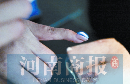 將指甲油涂在指甲上，靠近火焰時(shí)被引燃了
